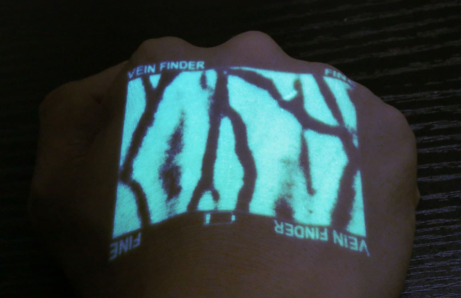 Vein Finder-product-application