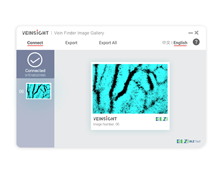 veinsight-Vein Image transfer